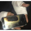 7 Daftar Hape yang Pernah Terbakar, Cari Tahu Sebelum Beli